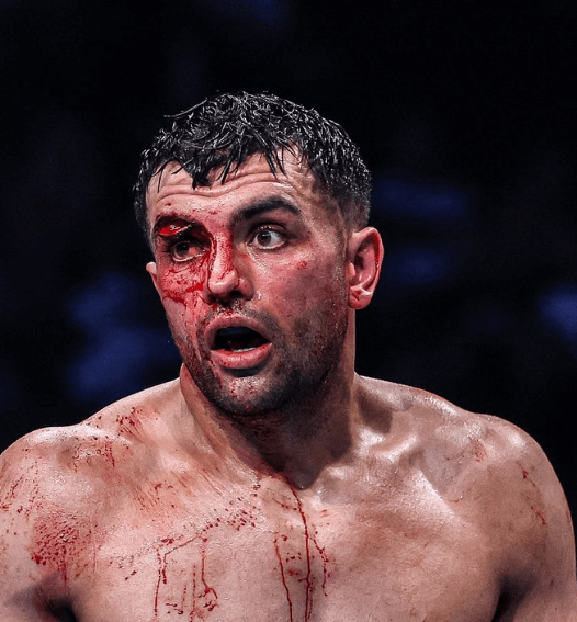 Catterall-vs-Eubank-Ends-Prematurely-Catterall-Wins-a-Technical-Decision